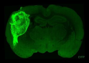 Organoides humanos de cerebro implantados en el cerebro en desarrollo de ratas recién nacidas