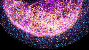 Desarrollo de organoides cerebrales a partir de tejido cerebral fetal humano