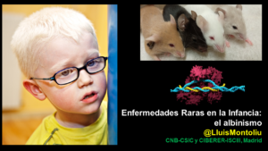 Enfermedades raras en la infancia: el albinismo