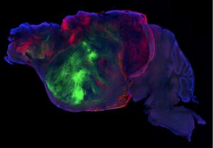 Un ratón con un cerebro humano